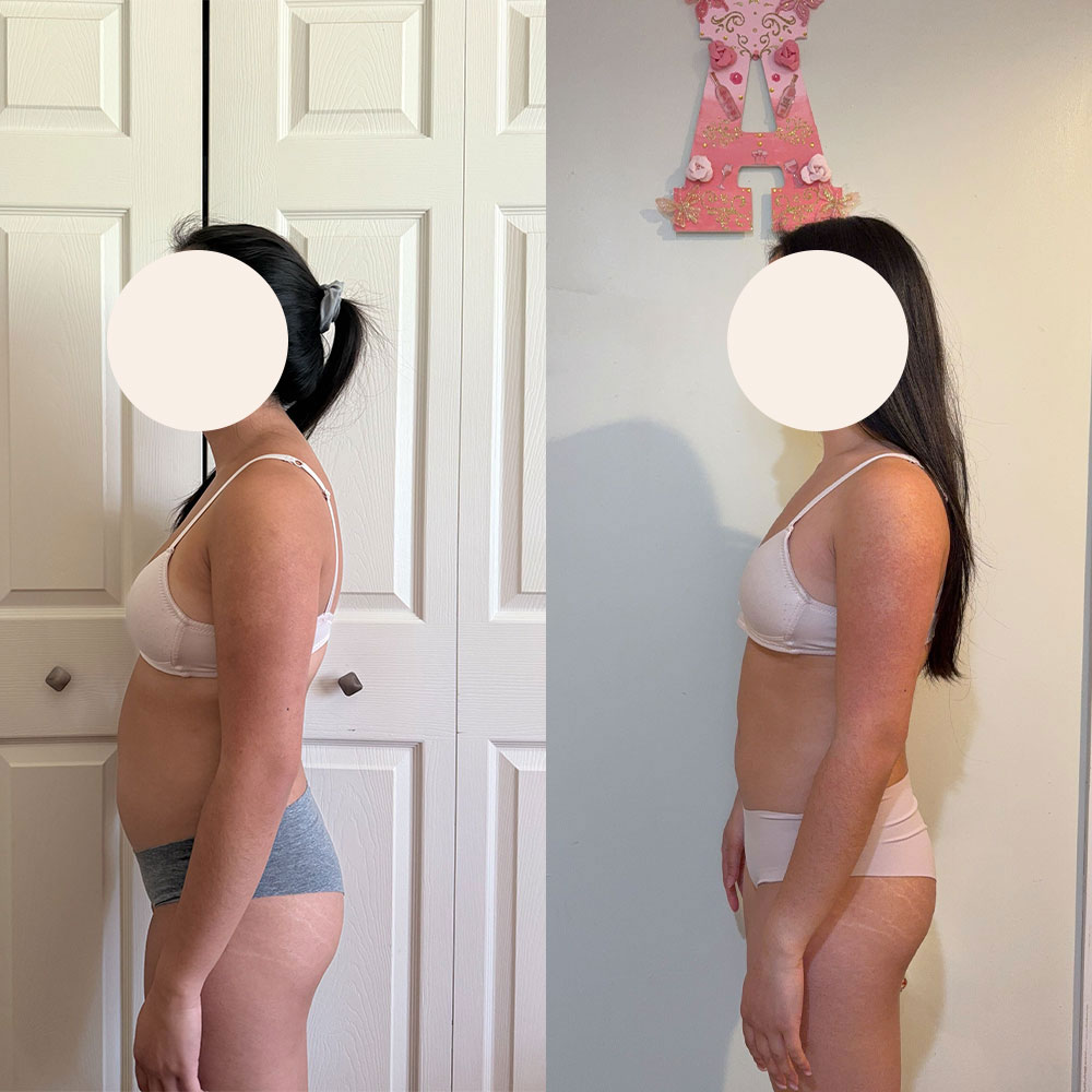 Transformation 3